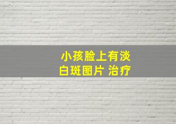 小孩脸上有淡白斑图片 治疗